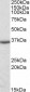 Goat Anti-DDAH1 Antibody